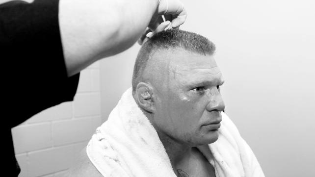 Brock with stitches